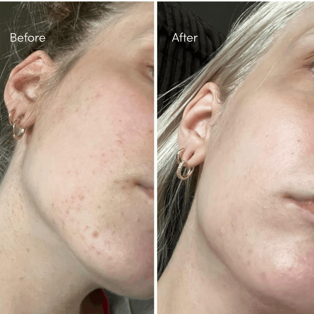 OUTGLOW - Radiance Tri-Factor™ Jelly